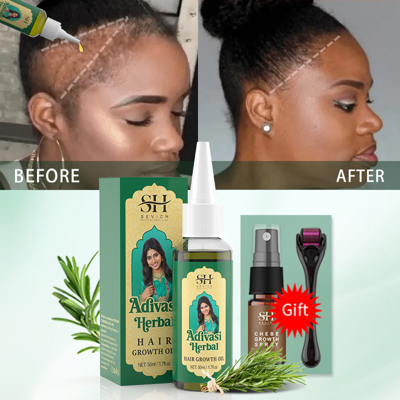 Ayurvedic Hair Growth Oil Indi - Hair Care Essence Oil recensione e prezzo