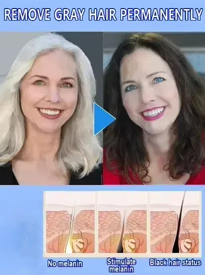 White hair killer, remove gray - Hair Care Natural Products recensione e prezzo