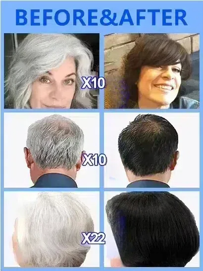 White hair killer, remove gray - Hair Care Natural Products recensione e prezzo