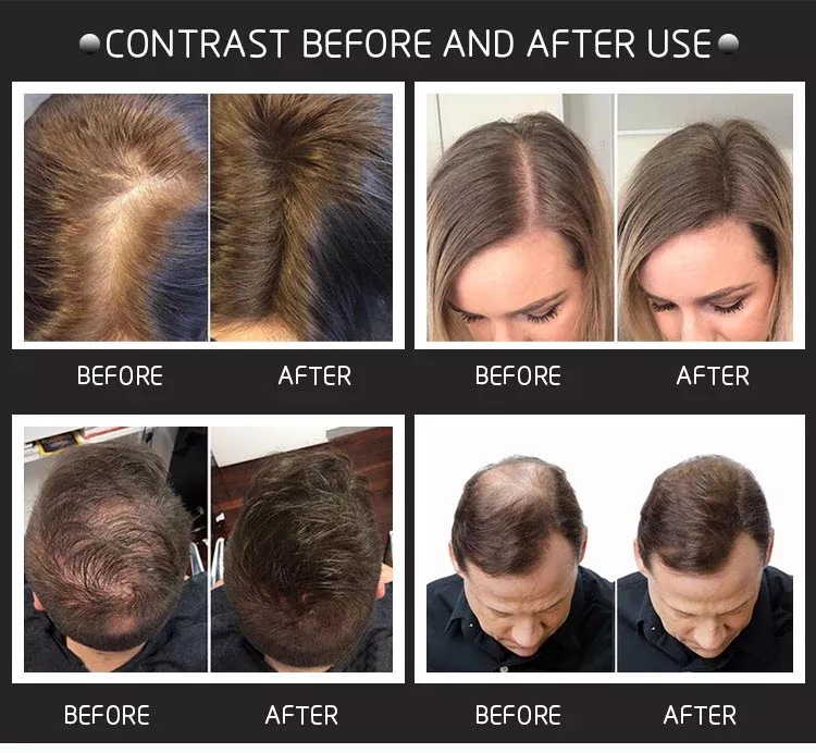 28g Hair Building Fibers Come  - Hair Care Natural Products recensione e prezzo