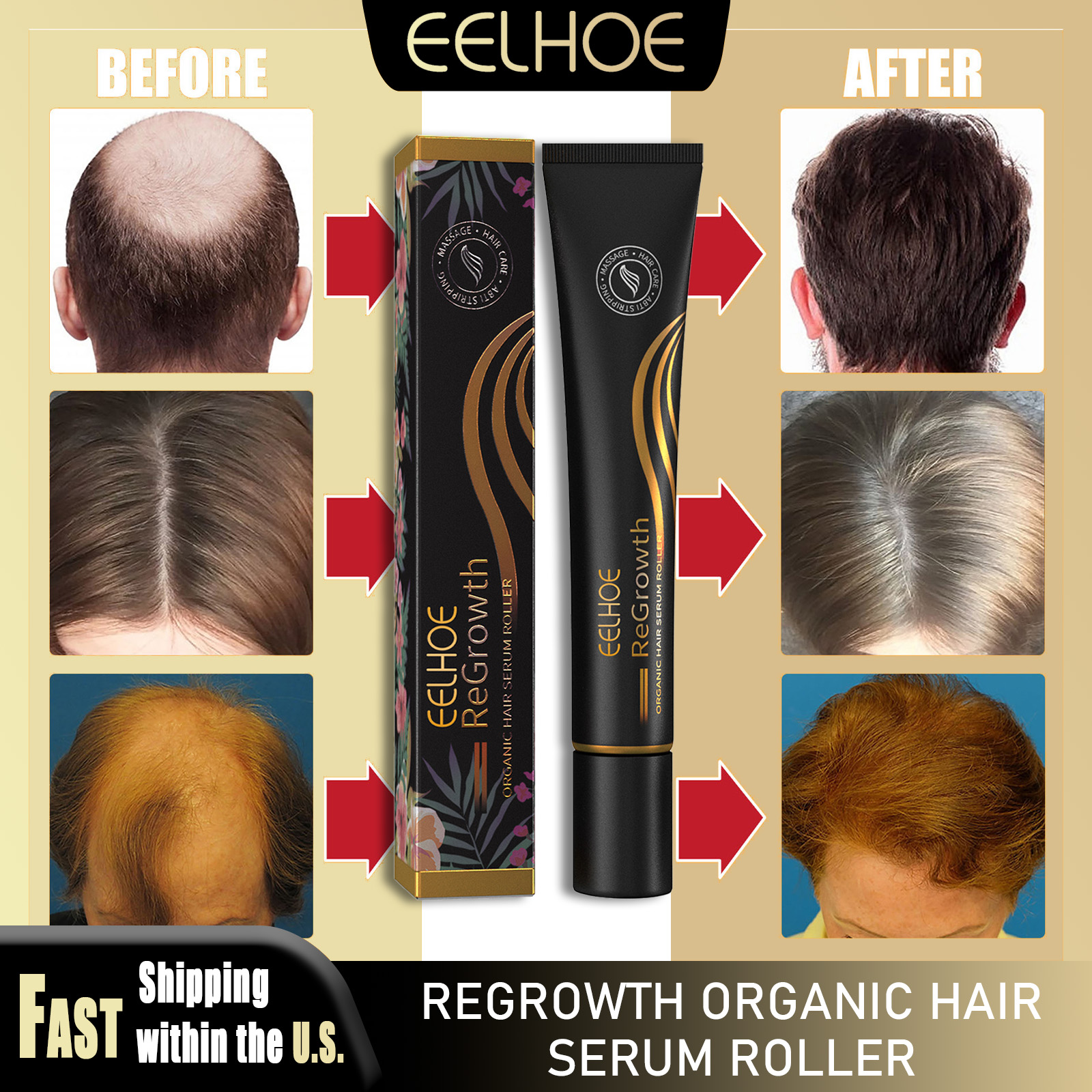 EELHOE Regrowth Hair Serum Wit - Hair Care Natural Products recensione e prezzo