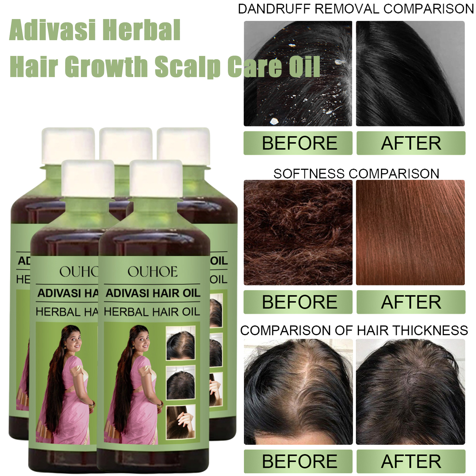 100ml Hair Growth Oil India Ad - Hair Care India recensione e prezzo