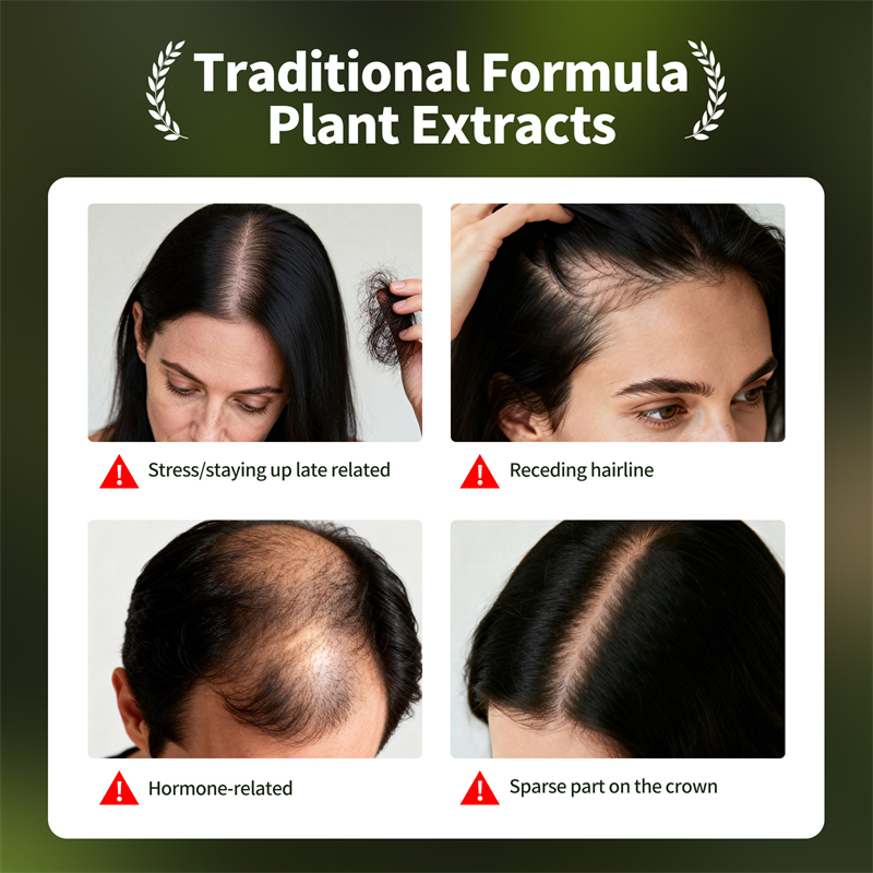 Natural Hair Growth Set Usman  - Hair Care Natural Products recensione e prezzo