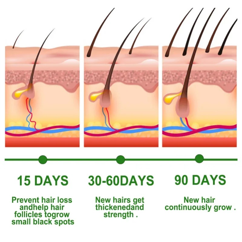 Hair Growth Serum Fast Growing - Hair Care Essence Oil recensione e prezzo
