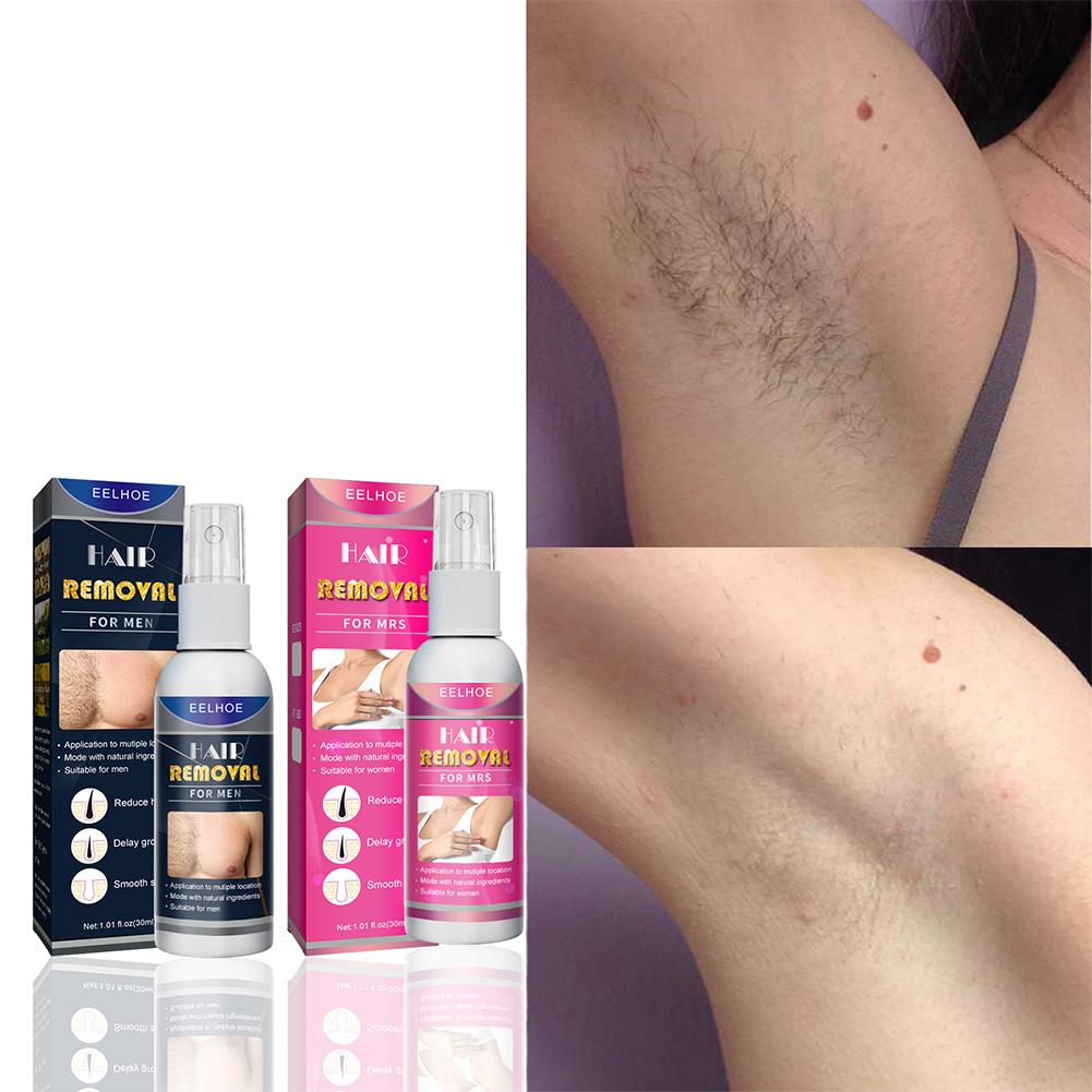 1/2PCS Super Natural Painless  - Hair Care China recensione e prezzo