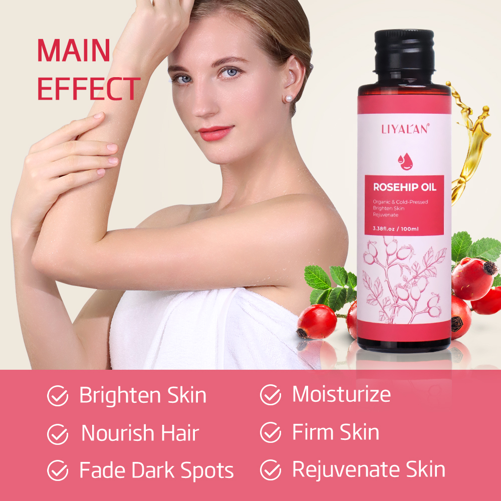 100ml Rosehip Oil Brighten Fir - Hair Care Essence Oil recensione e prezzo