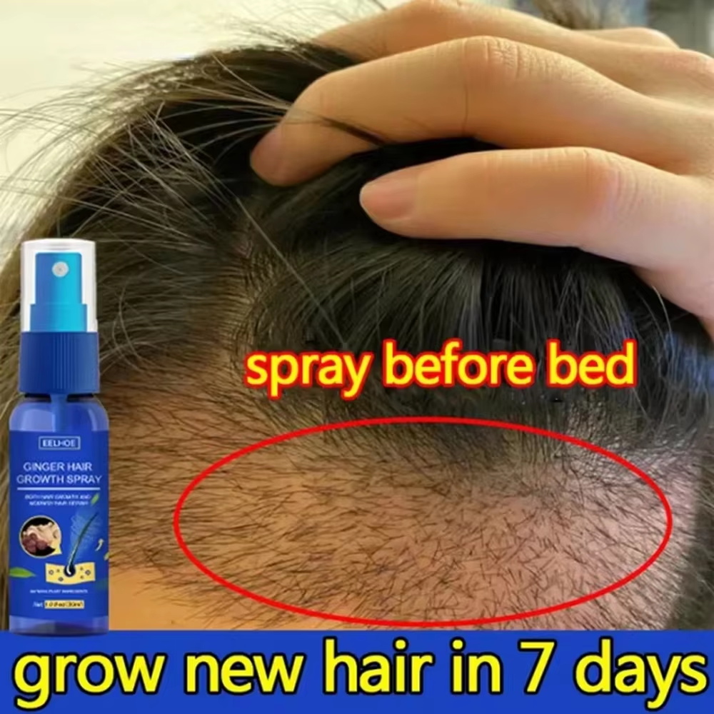 Fast Ginger Hair Growth Spray  - Hair Care Natural Products recensione e prezzo