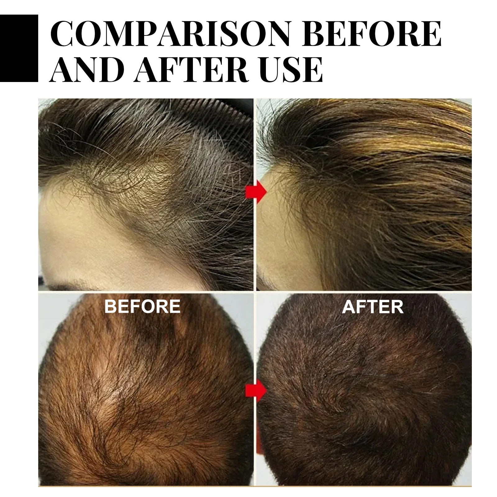 Fast Ginger Hair Growth Spray  - Hair Care Natural Products recensione e prezzo