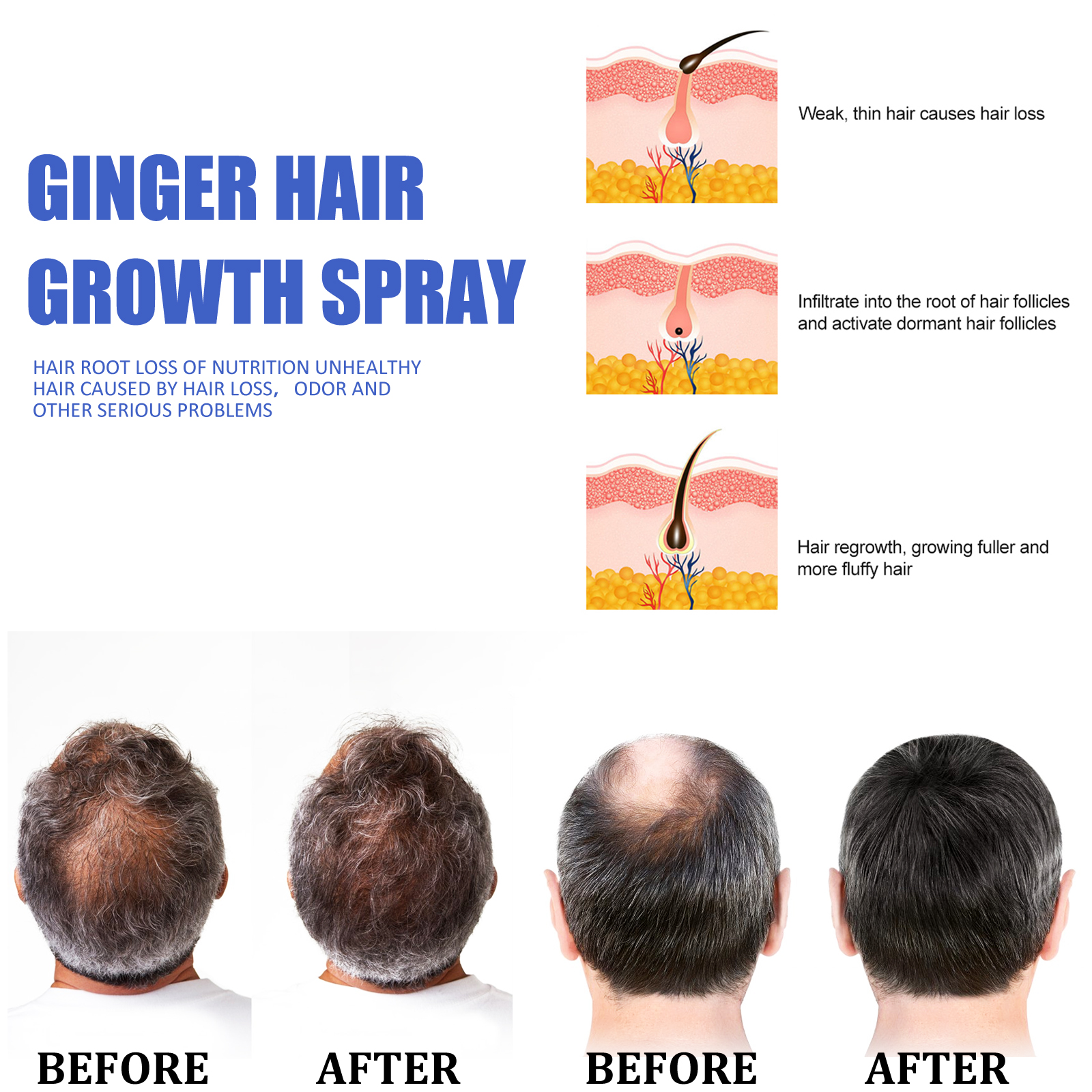 Fast Ginger Hair Growth Spray  - Hair Care Natural Products recensione e prezzo