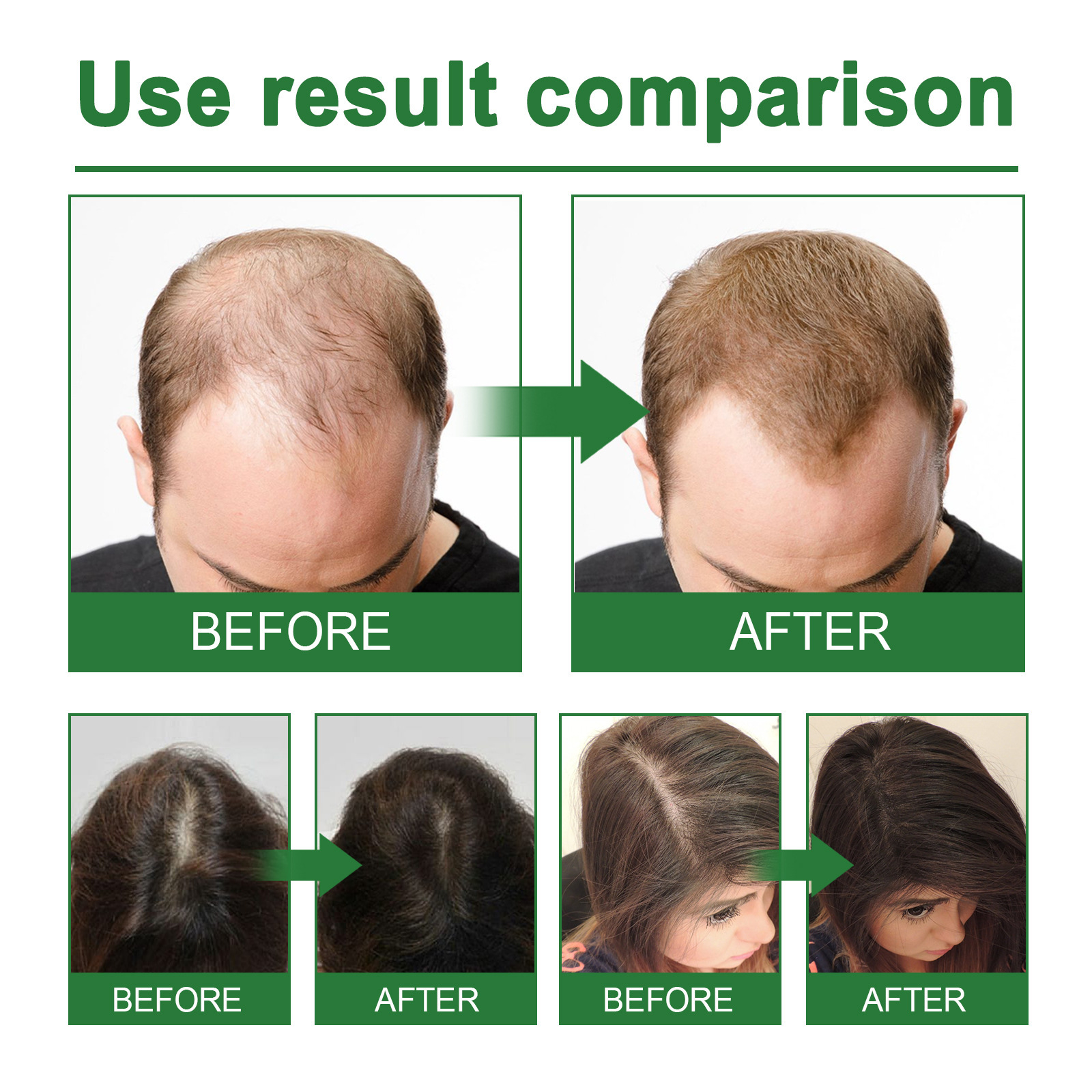 Rosemary Spray for Hair Nouris - Hair Care Natural Products recensione e prezzo