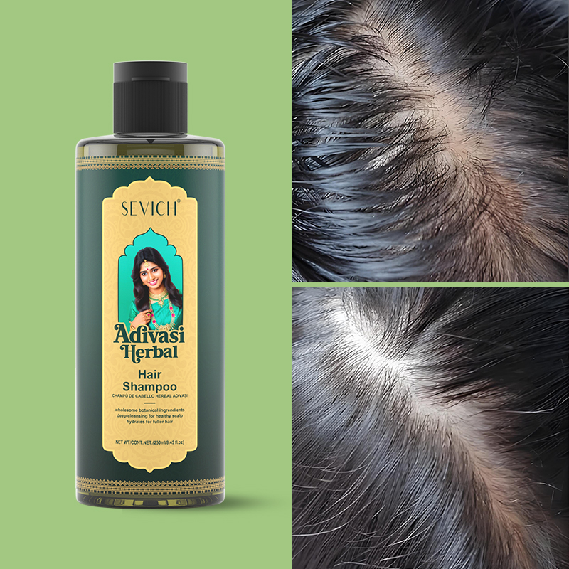 Hair Growth Oil Set Rosemary H - Hair Care India recensione e prezzo